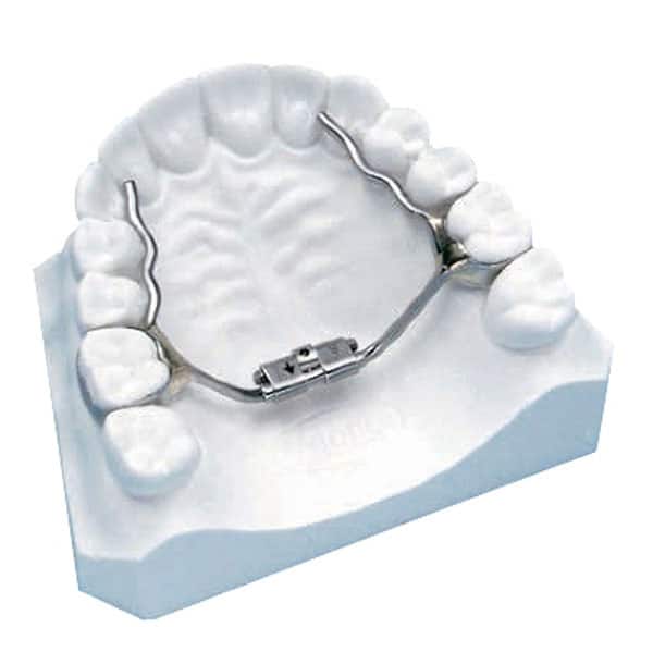 Palatal expanders on clay models